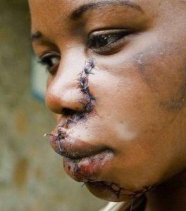Attacks by Rebel soldiers are often brutal
